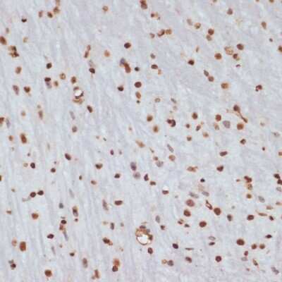 Immunohistochemistry-Paraffin: Chk1 [p Ser280] Antibody - Azide and BSA Free [NBP3-05379]